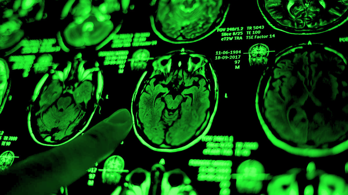 „Tiesioginės patirties klaida“ psichodelikų tyrimuose: ketamino ir MDMA vertinimas - Peter Barglow - Straipsnis - Skeptikų draugija 3